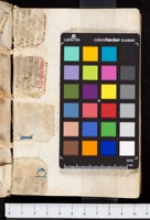 mds_09Aa09_anteriore